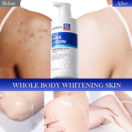 42% Urea Smoothing Body Lotion