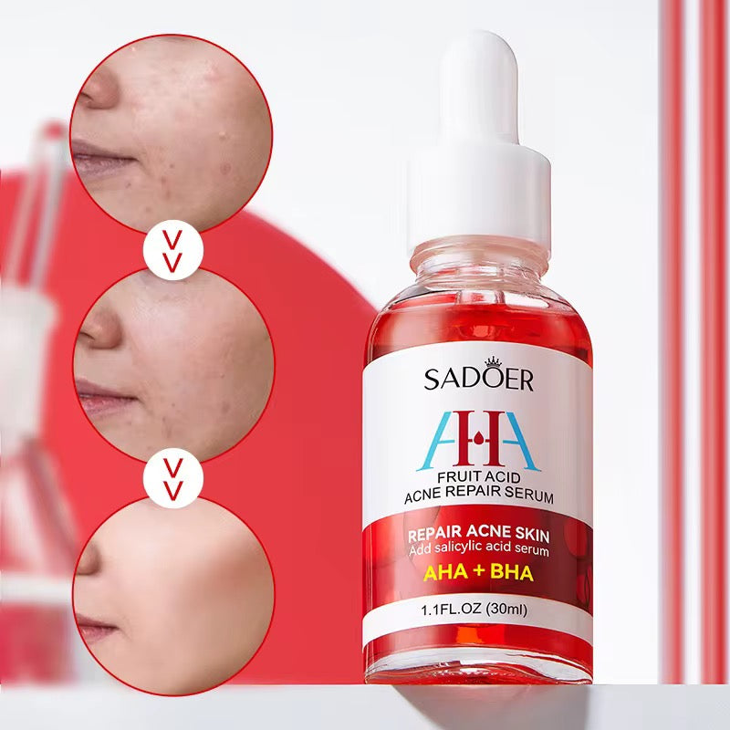 AHA + BHA Fruit Acid Acne Repair Serum – Clear, Smooth & Renew Your Skin