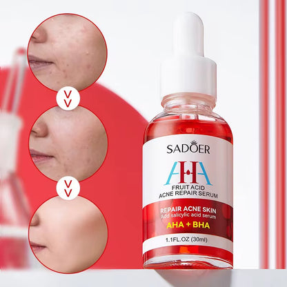 AHA + BHA Fruit Acid Acne Repair Serum – Clear, Smooth & Renew Your Skin