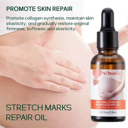 Stretch Mark Repair Oil – Nourishing Care for Stretch Marks & Scars