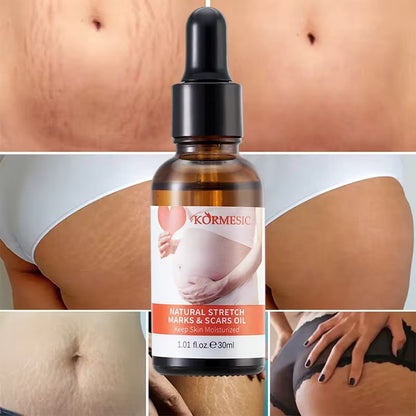 Stretch Mark Repair Oil – Nourishing Care for Stretch Marks & Scars