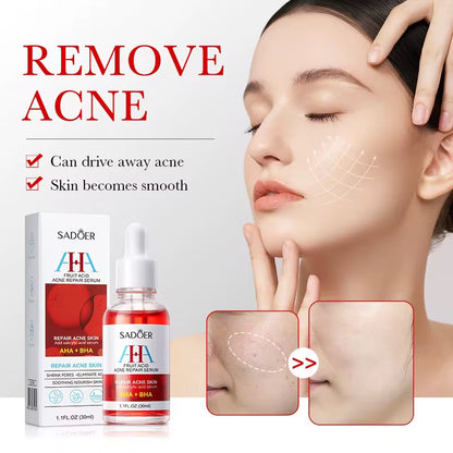 AHA + BHA Fruit Acid Acne Repair Serum – Clear, Smooth & Renew Your Skin