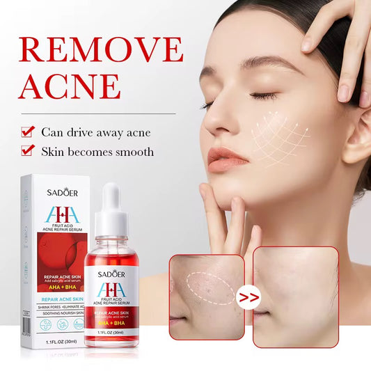 AHA + BHA Fruit Acid Acne Repair Serum – Clear, Smooth & Renew Your Skin