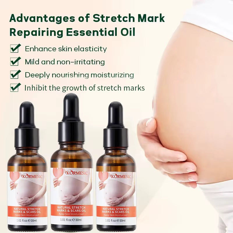 Stretch Mark Repair Oil – Nourishing Care for Stretch Marks & Scars