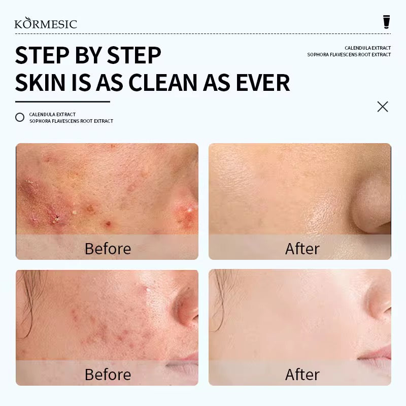 Herbal Feminine Yoni Wash – Gentle Daily Intimate Cleanser