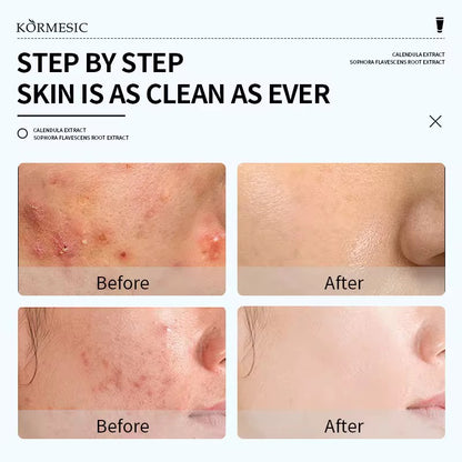 Herbal Feminine Yoni Wash – Gentle Daily Intimate Cleanser