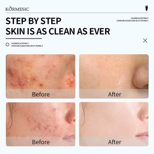 Herbal Feminine Yoni Wash – Gentle Daily Intimate Cleanser